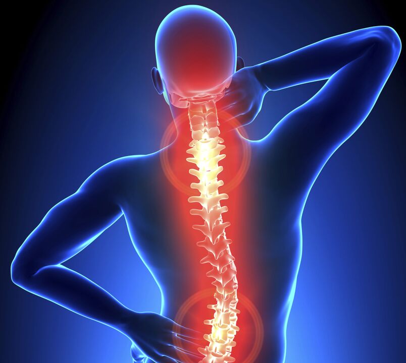 Bizkarrezurraren osteokondrosia